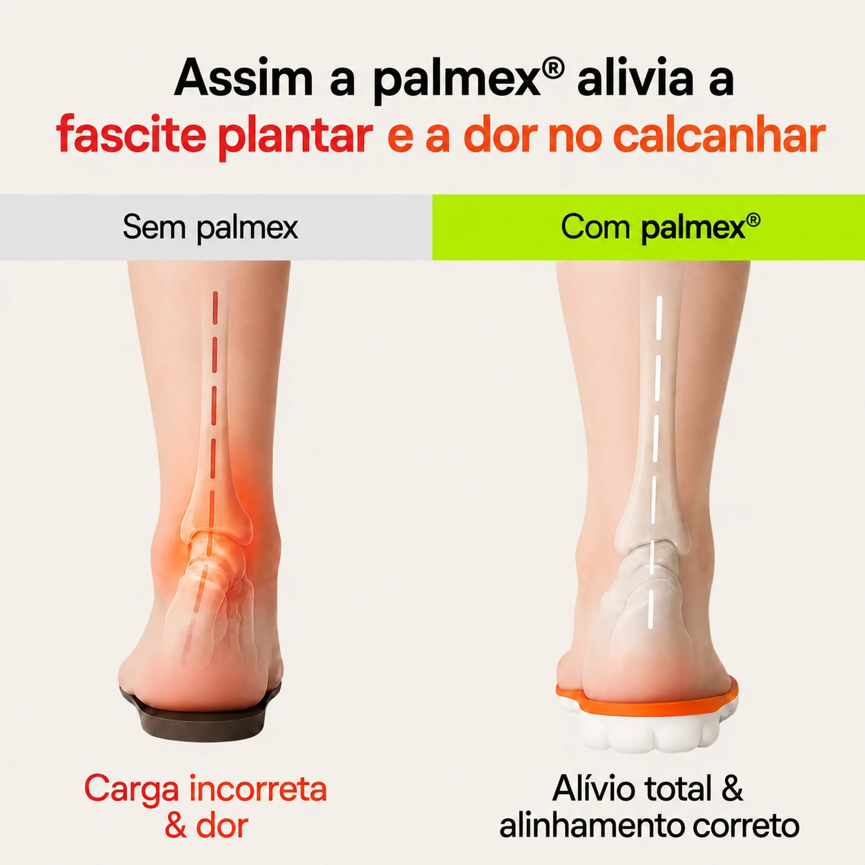 Palmex — detalhes da palmilha